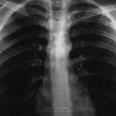 травмы & Obraz & Billian - Если в сердце живет любовь ()