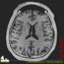 Tone Boyz - Hallucinogens