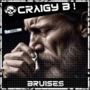 Craigy B! - Bruises (Original Mix)